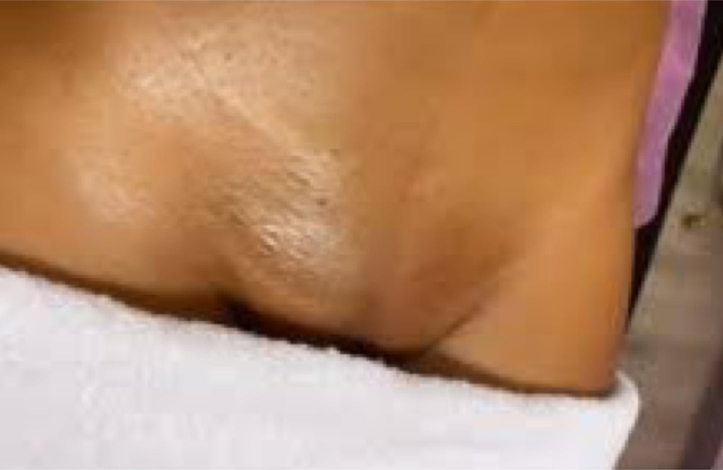 Brazilian & UnderArm Wax Combo